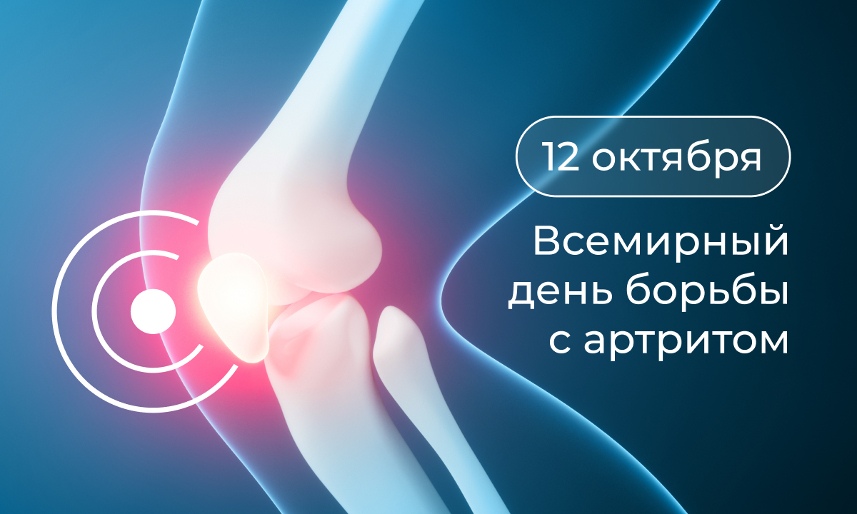 Как распознать артрит вовремя