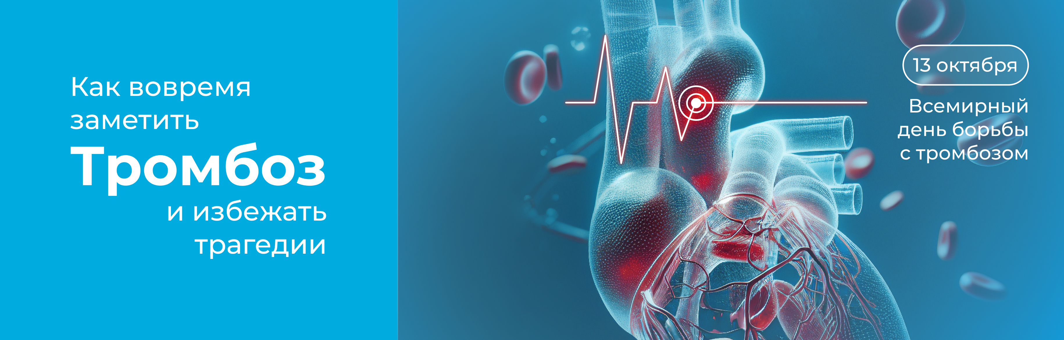 Тромбоз: симптомы, диагностика, лечение