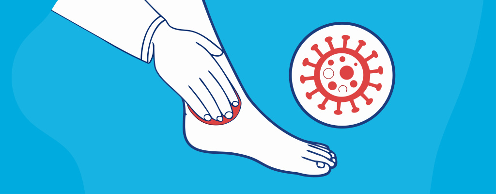 Столбняк_001.jpg Столбняк_001.jpg