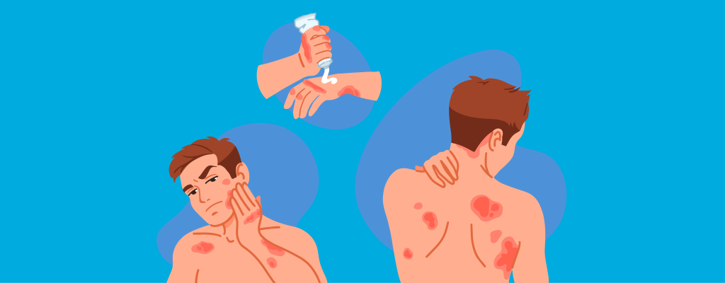 Атопический дерматит_001 копия.png