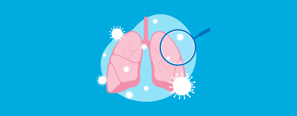 Аспергиллез легких_2050х800_статьи-3.jpg