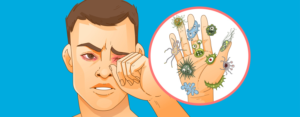 конъюнктивит_001 копия.jpg