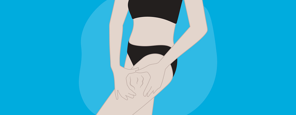 Целлюлит: почему мы его боимся?