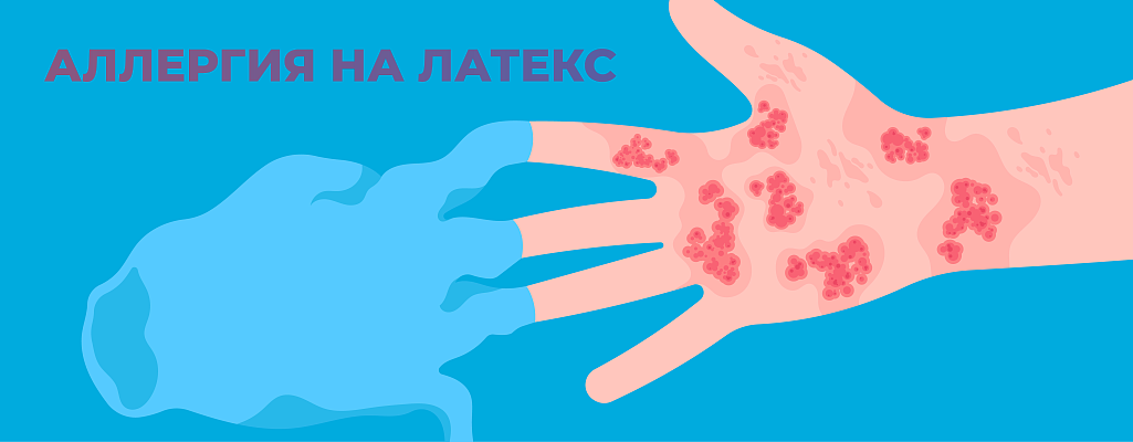 Аллергия на латекс: причины, симптомы и что делать