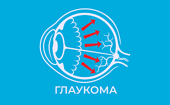 Глаукома: что это за болезнь, симптомы, причины и лечение