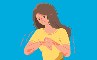 Аллергия на руках: симптомы, причины и эффективное лечение