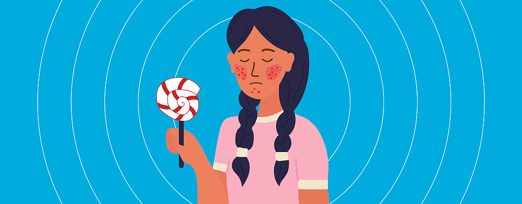 Аллергия на сладкое