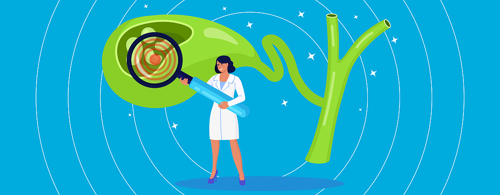 Холецистит