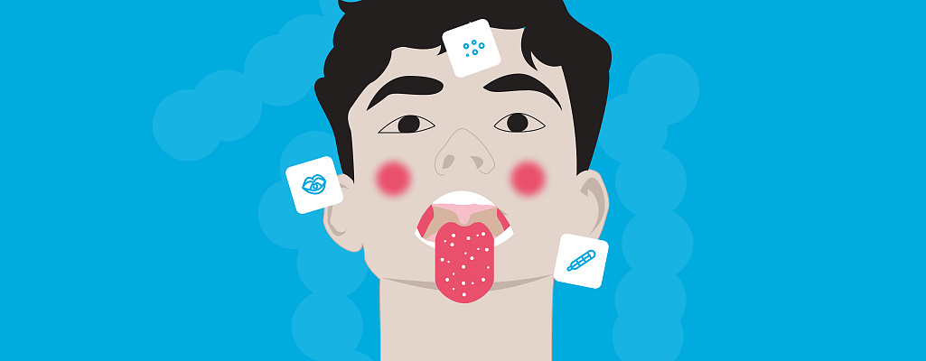 Скарлатина