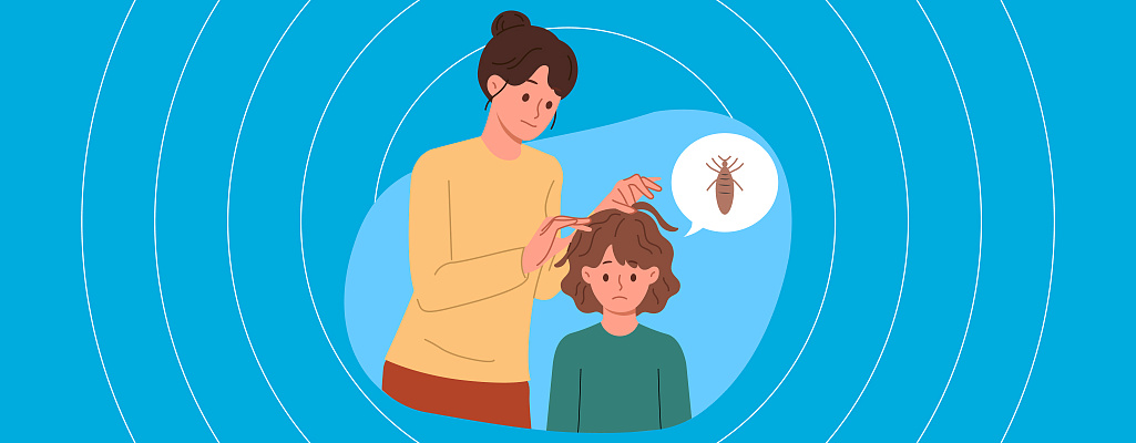 Педикулёз: почему появляется и чем опасен