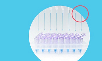 Диагностическая значимость определения циклических нуклеотидов в лейкоцитах больных сахарным диабетом 1 и 2 типов