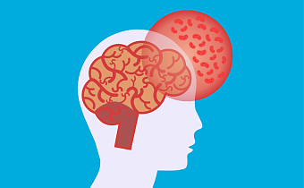 Гнойный менингит