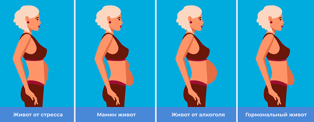 «Гормональный живот» у женщин: причины, симптомы и как убрат