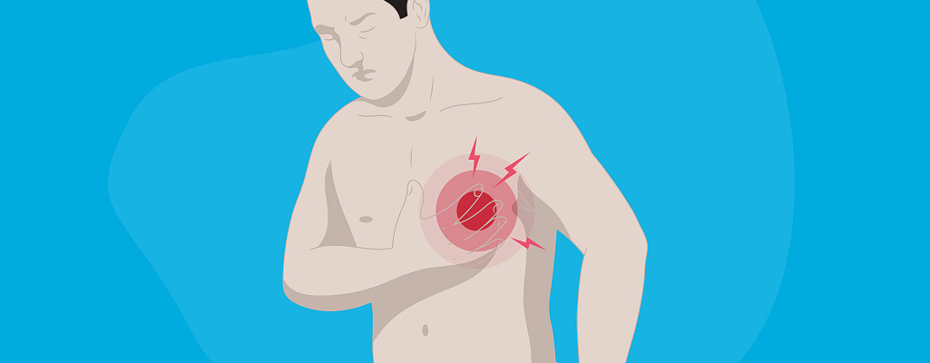 Межрёберная невралгия: междисциплинарный взгляд на старую проблему