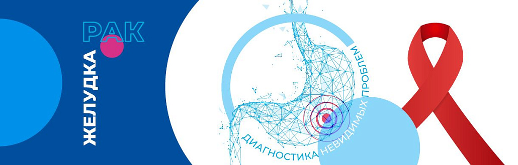 Рак желудка. Диагностика невидимых проблем.