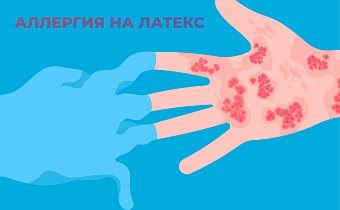 Аллергия на латекс: причины, симптомы и что делать