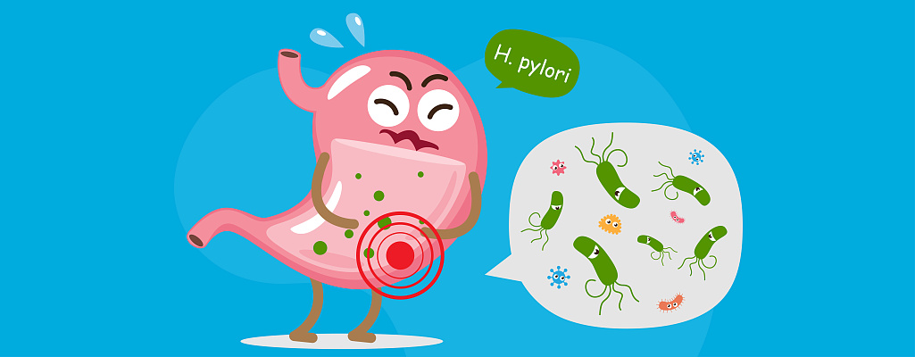 Хеликобактер пилори (Хеликобактериоз): симптомы, схемы лечения и диагностика