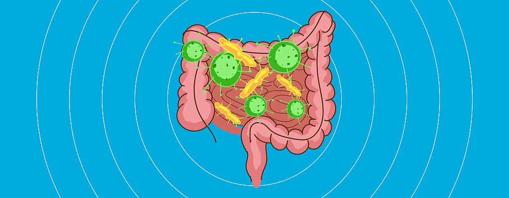Ротавирусная инфекция
