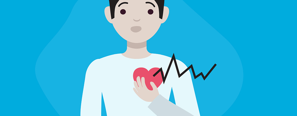 Тахикардия