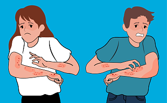 Атопический дерматит