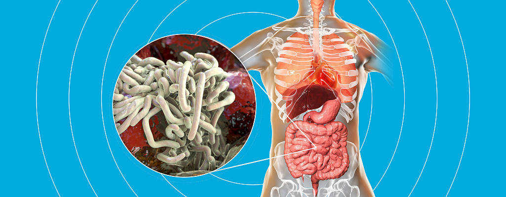 Энтеробиоз