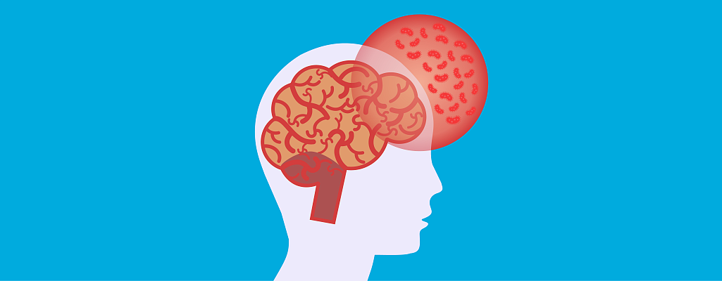 Гнойный менингит