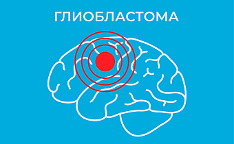 Глиобластома головного мозга: что это такое, симптомы и лечение