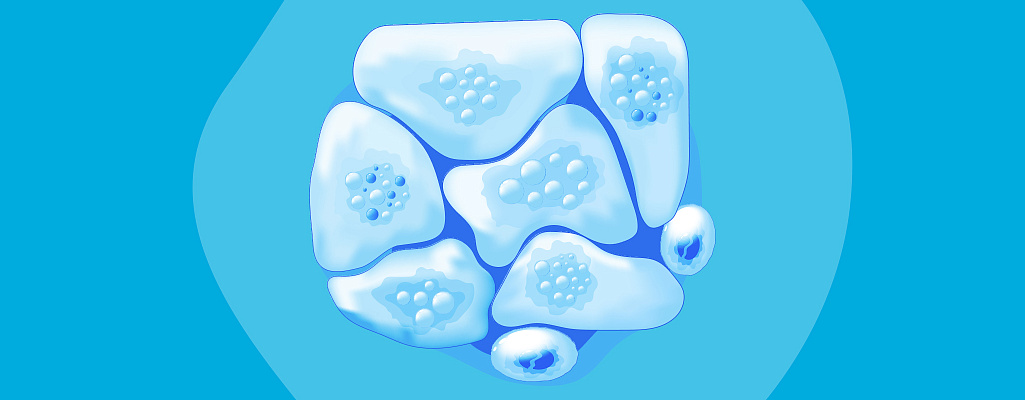 Признаки и симптомы рака