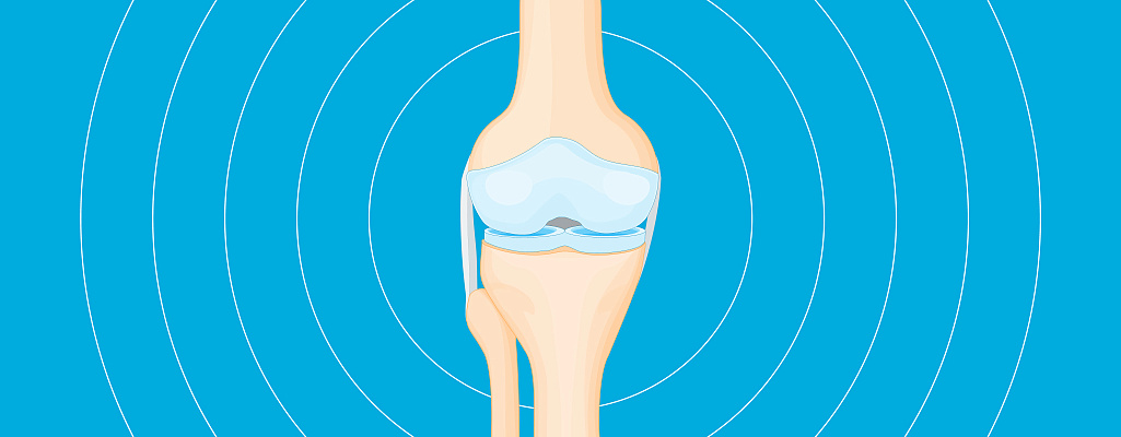 Боль в суставах (артралгия)