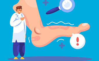 Аллергия на ногах: причины, признаки и что делать