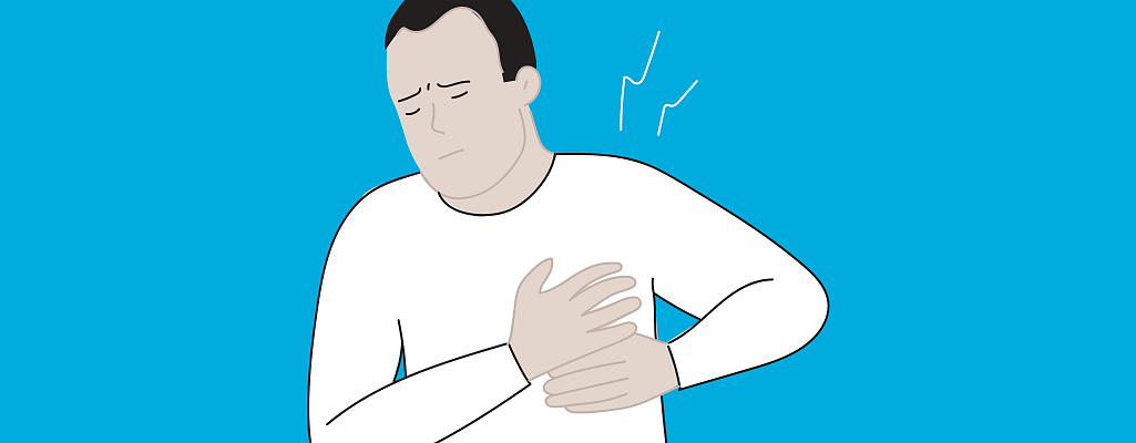 Инфаркт миокарда