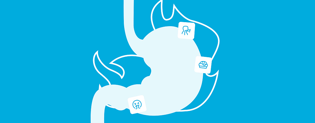 Изжога: причины, симптомы, эффективные методы лечения