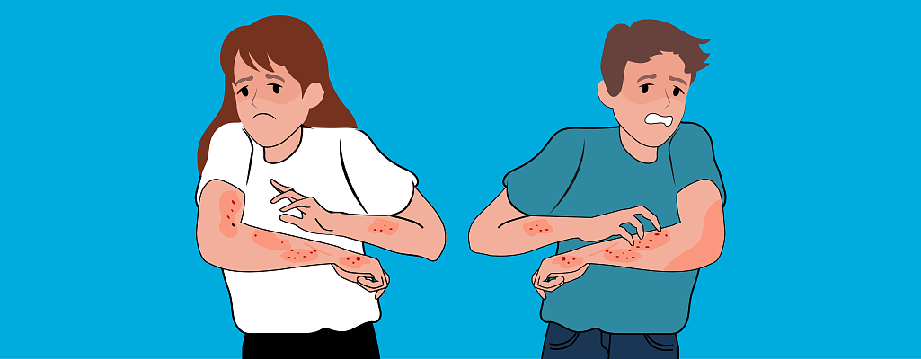 Атопический дерматит