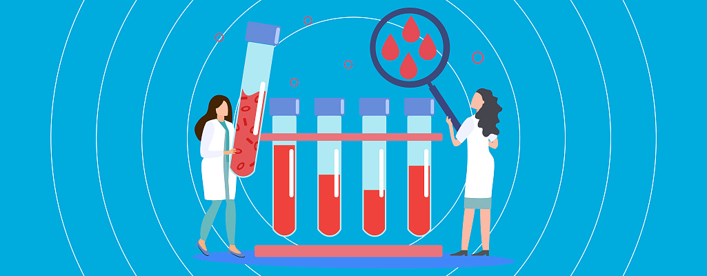 ВИЧ-инфекция: причины, проявления и исходы