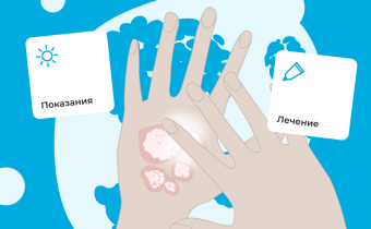 Псориаз (или чешуйчатый лишай)